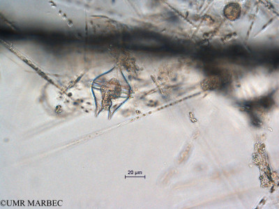 phyto/Scattered_Islands/all/COMMA April 2011/Protoperidinium cf claudicans (ancien Protoperidinium sp14)(copy)_thumb.jpg